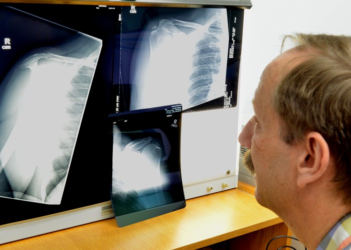 Atherton Hip Transplants