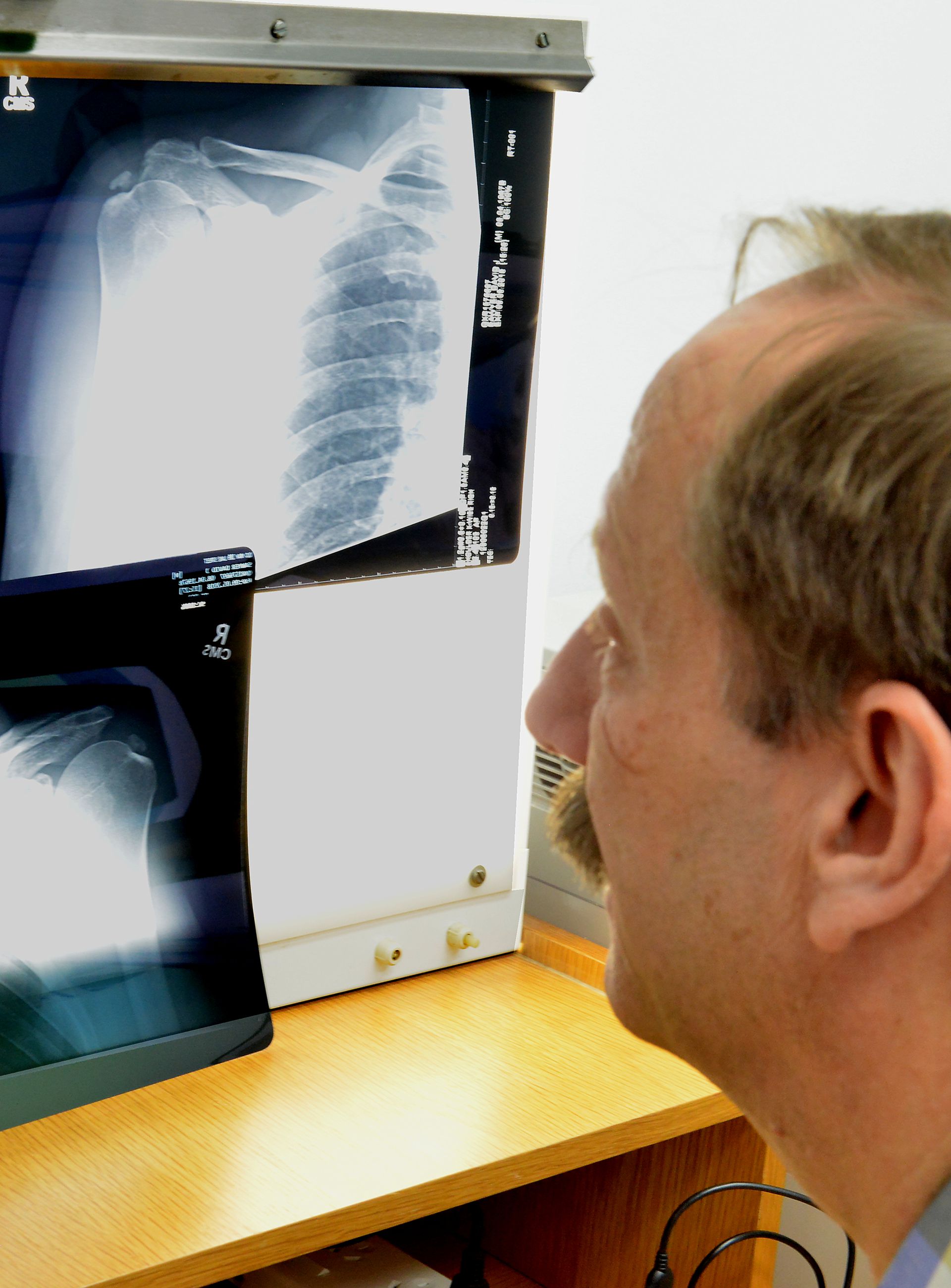 Atherton Orthopaedic Surgeon