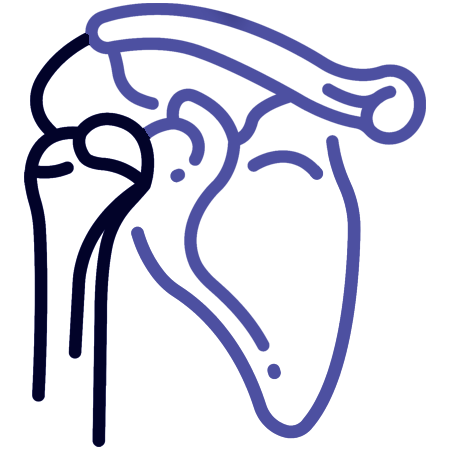 Cairns Hip Transplants